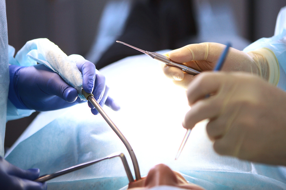 implant dentar